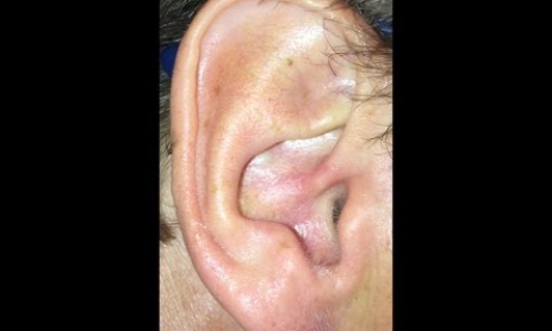 Hidden inside my ear